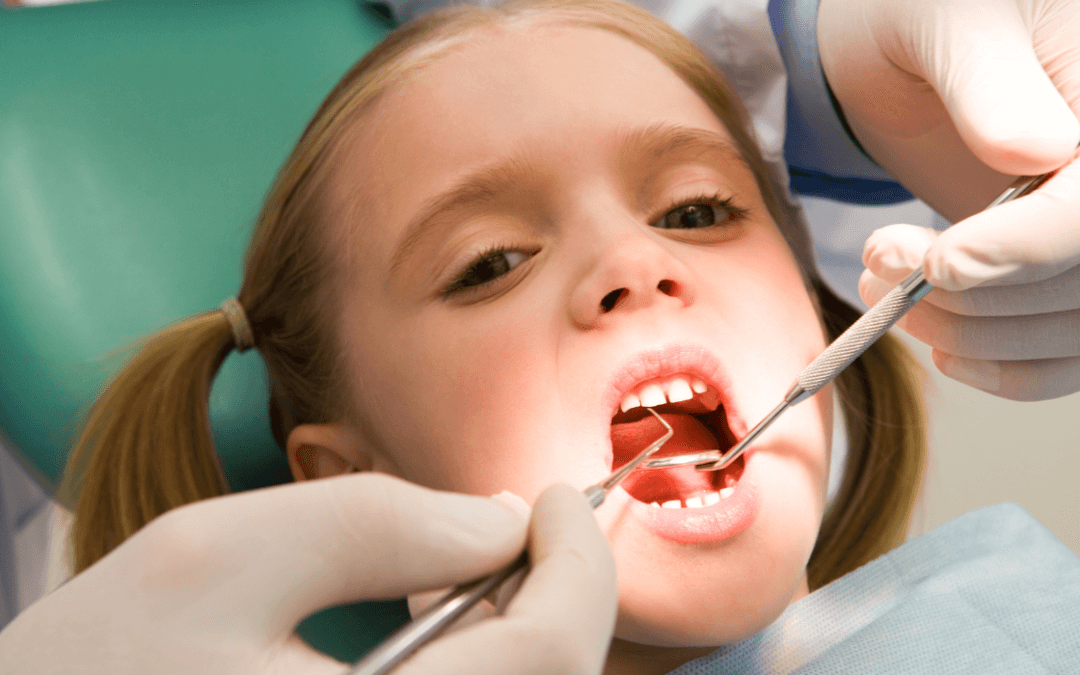 Skloinomerný cement v detskej stomatológii: Bezpečná voľba pre mladých pacientov